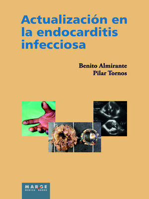 cover image of Actualización en la endocarditis infecciosa